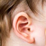 ear-wax-removal-vcare